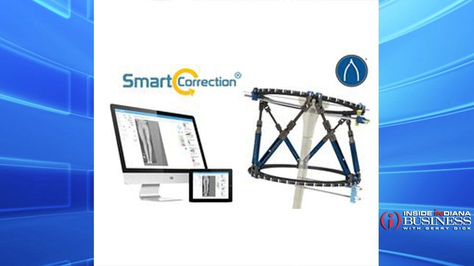 Wishbone Medical receives FDA clearance for its Smart Correction External Fixation System