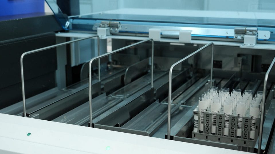 Isot Test Roche gets FDA approval for Alzheimer’s blood test – Inside INdiana ...